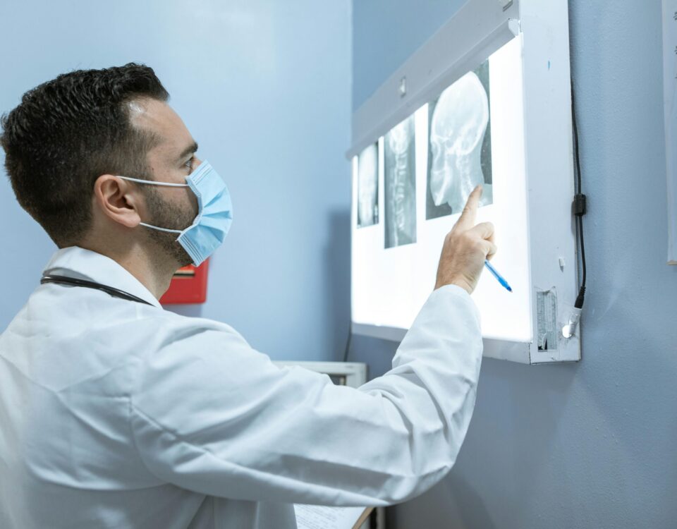 Allied Health Professional examining skull X-ray images on a lightboard during a medical diagnostic review.